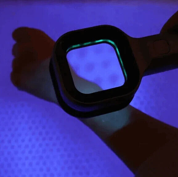 UV Woods Lamp Examination Dermatology Skin Anyalyzer, Bed Bug Inspection