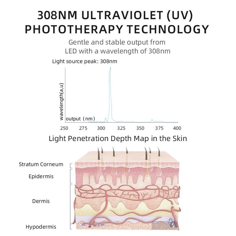 308nm UVB Light Therapy 4.5 cm2 for general skin area with 9 LEDs