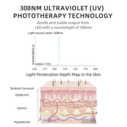 308nm UVB Light Therapy 9 cm2 for larger areas