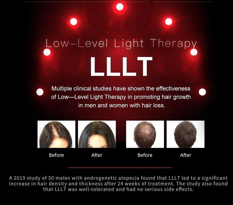 Laser Hair Growth Cap - Red Light Therapy for Hair Regrowth - 20 Min auto timer