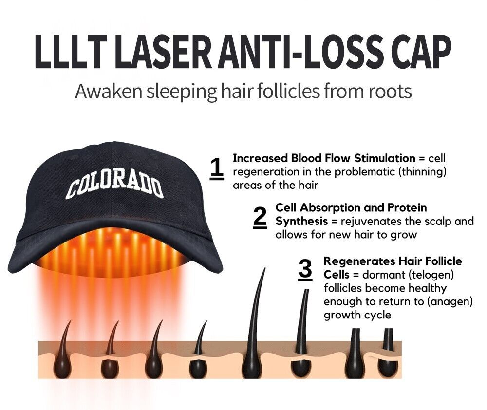 Laser Hair Growth Cap - Red Light Therapy for Hair Regrowth - 20 Min auto timer