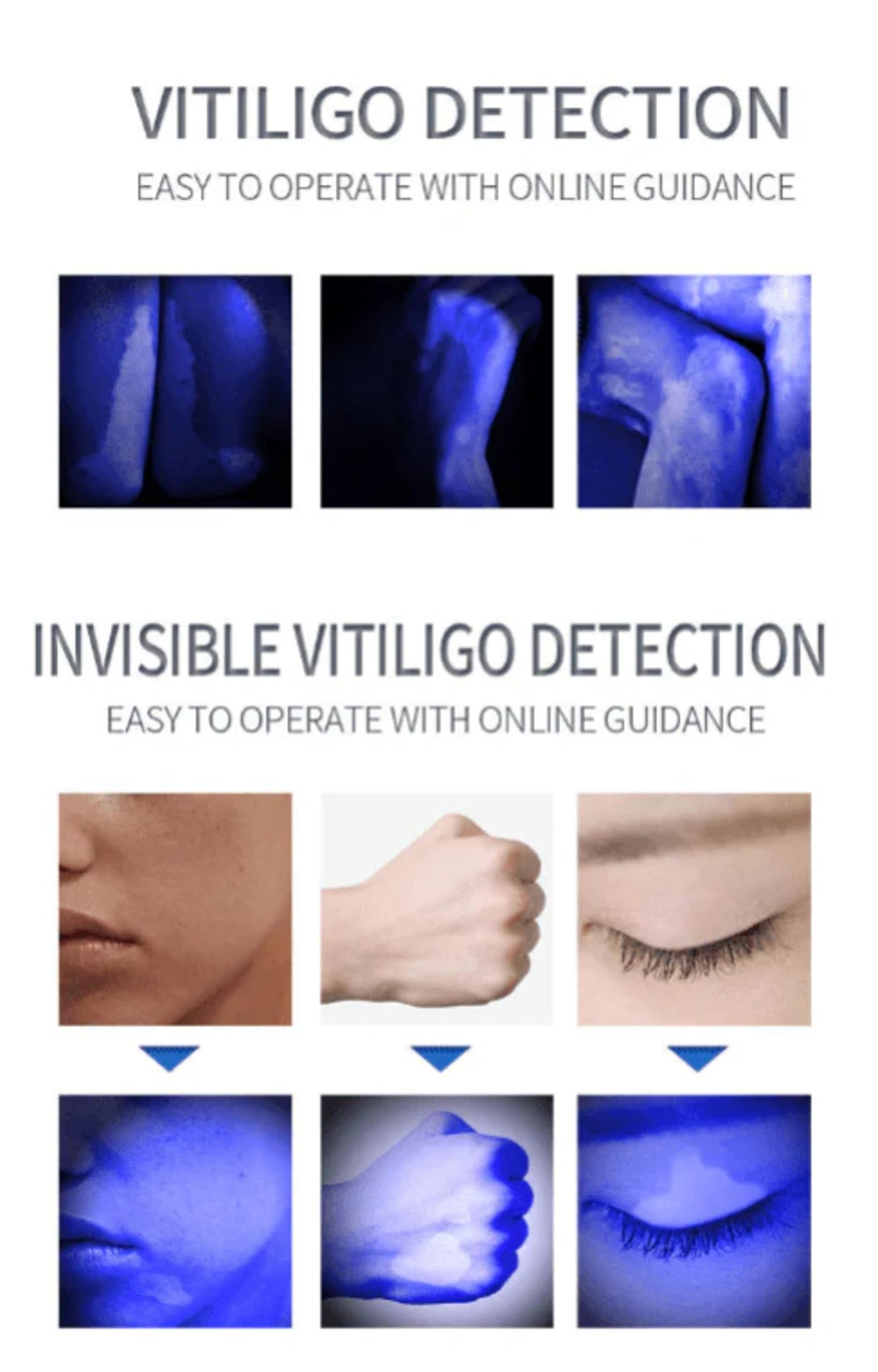 Wood's Lamp Skin Inspection Light for Professional and Personal Care Use